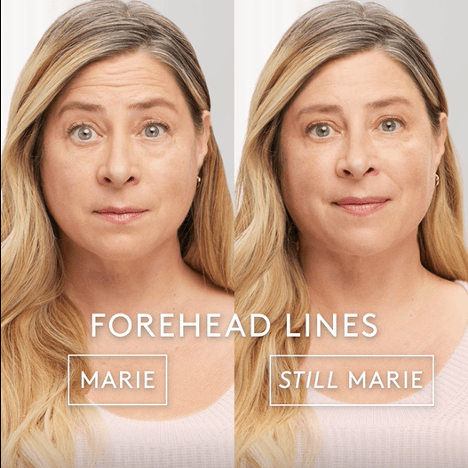 Before and After 1