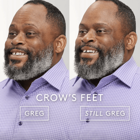 Before and After 1