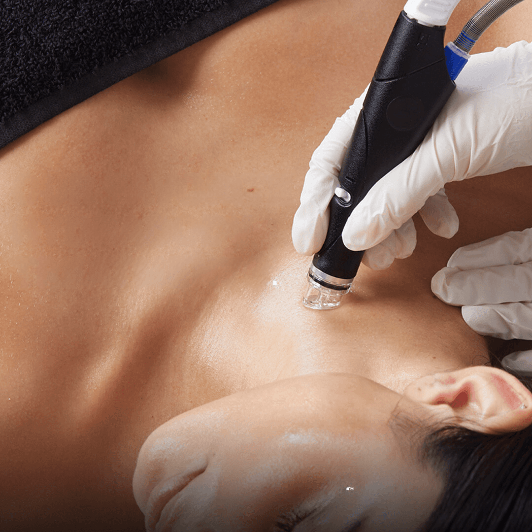Platinum HydraFacial®