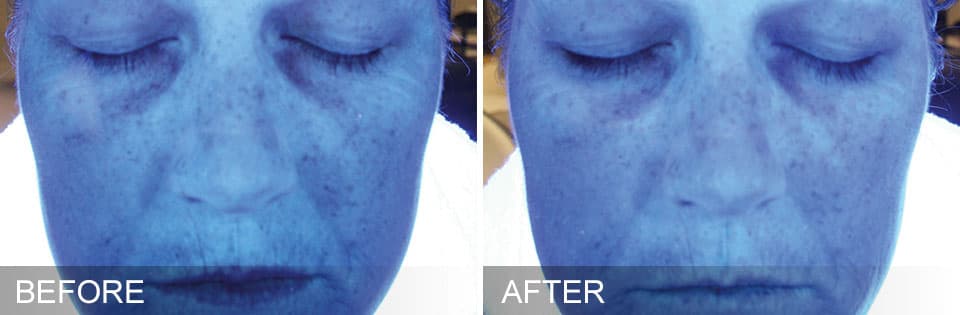 Before and After 1